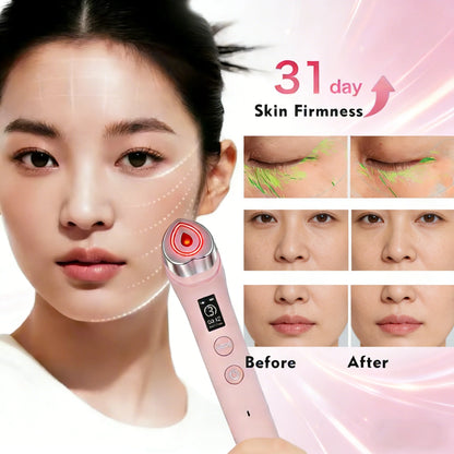 5 Modes RF Facial Beauty Device, Anti-Aging Skin Tightening Massager for Pore Refining & Skincare Absorption