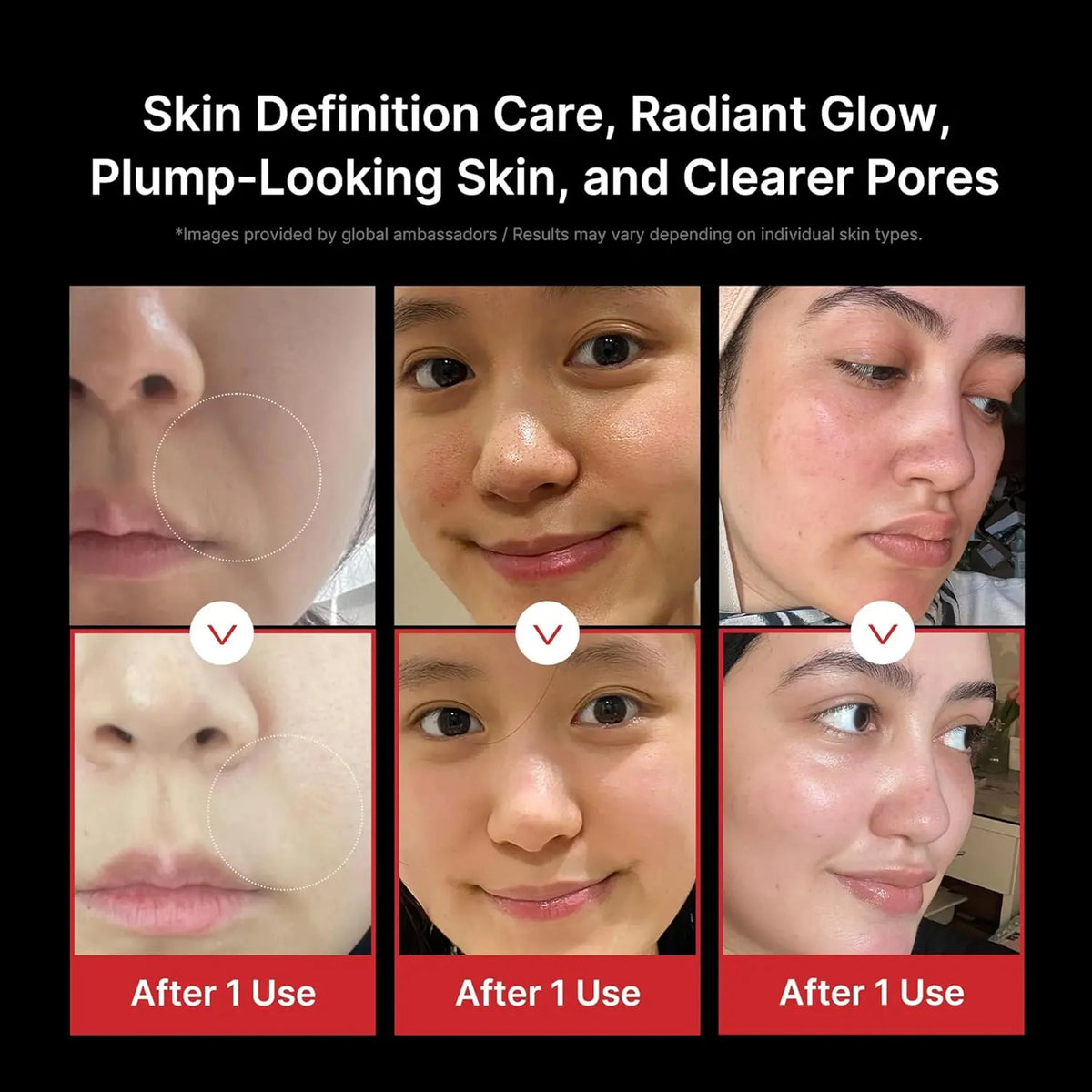 5 Modes RF Facial Beauty Device, Anti-Aging Skin Tightening Massager for Pore Refining & Skincare Absorption