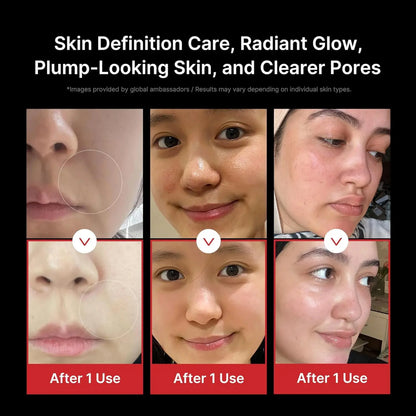 5 Modes RF Facial Beauty Device, Anti-Aging Skin Tightening Massager for Pore Refining & Skincare Absorption