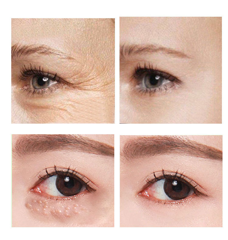 Beauty Eye Cream30mlwish